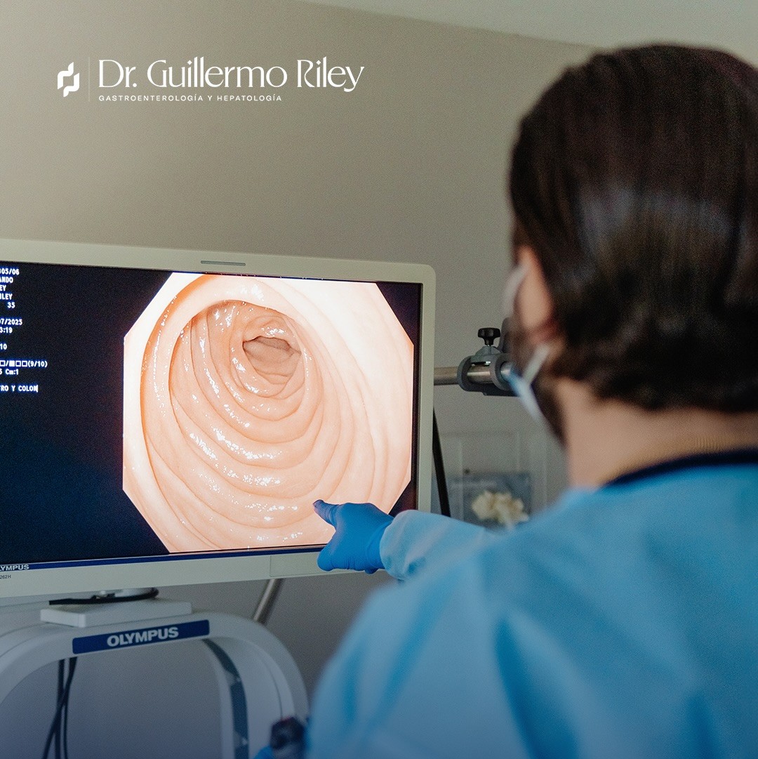 Gastroendoscopia